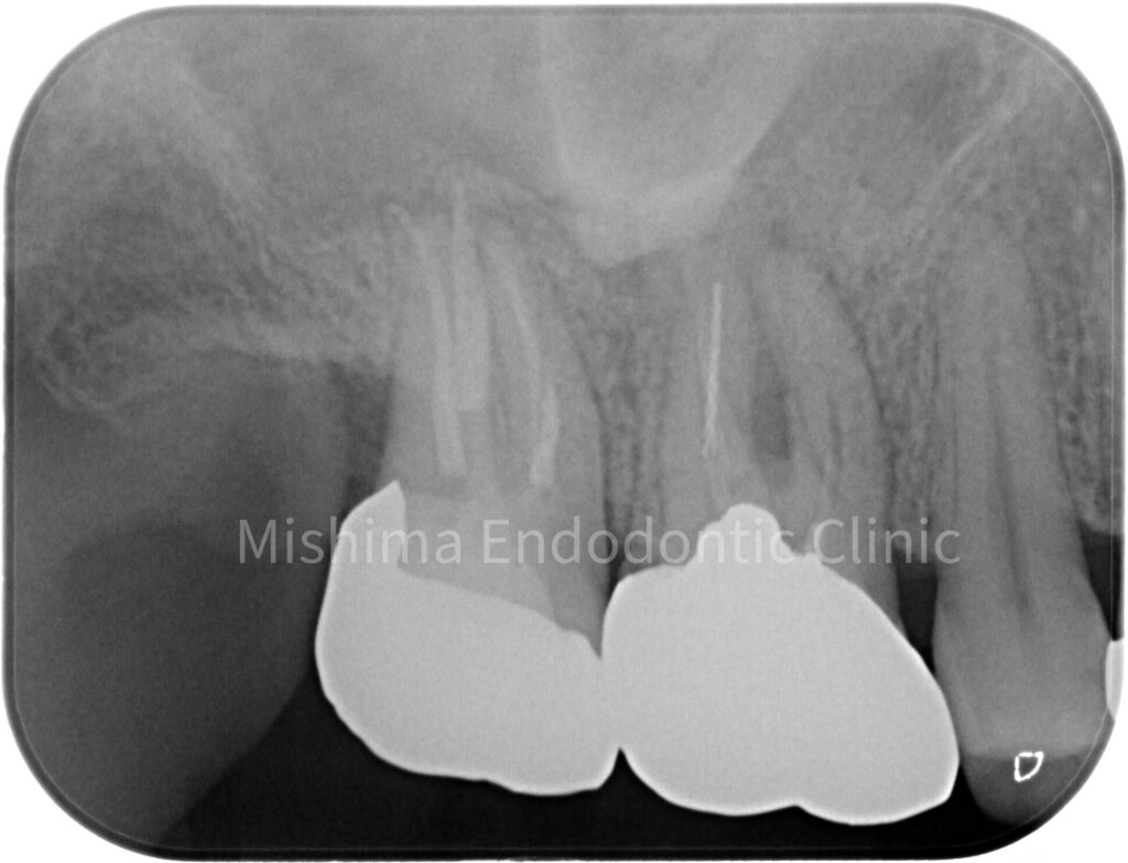 ⚠️裁断済み　藤本研修会　Endodontology 静岡の根管治療・歯内療法｜みしま歯内治療院